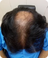 Before