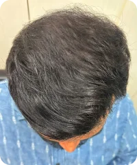 After