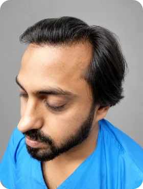Patient hair loss status before treatment